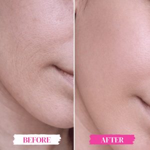 Age Minus Cream - Skinmath