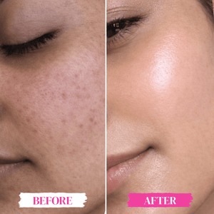 Glow Multiplier Serum - Skinmath