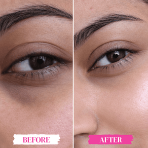 Zero Puff Eye Gel - Skinmath